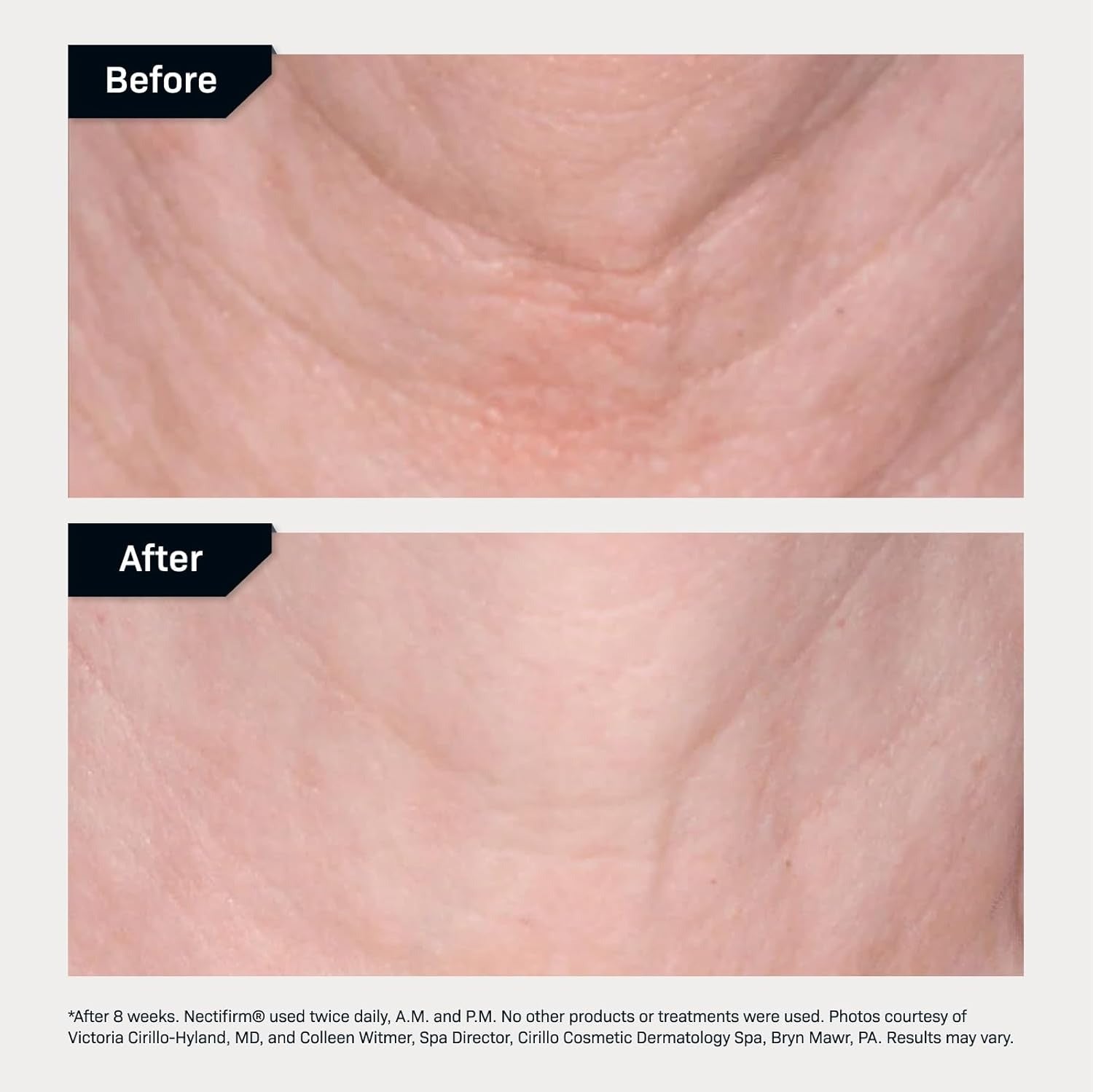 Revision Skincare-Nectifirm Advanced 1.7 oz