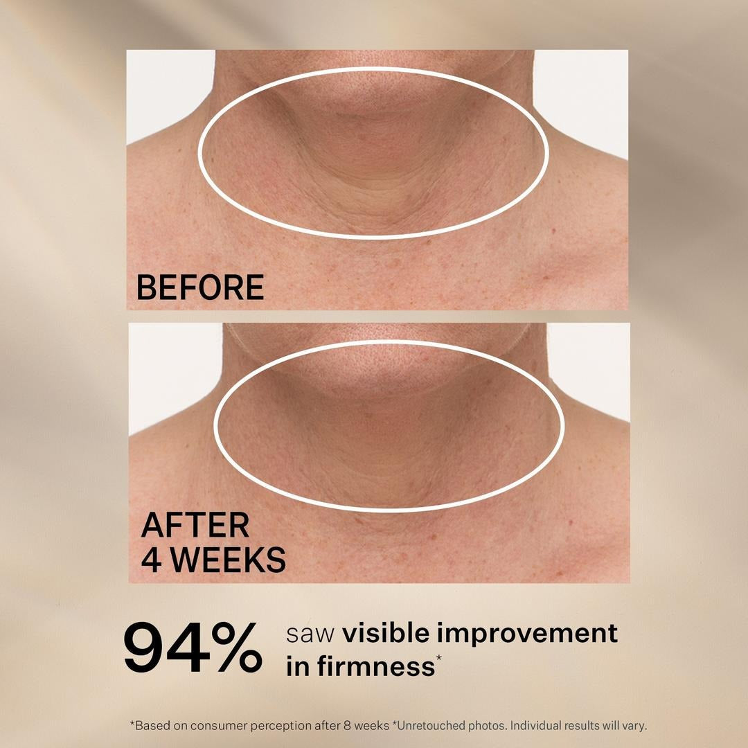 StriVectin TL Advanced Tightening Neck Cream Plus-30ml/ 1fl oz.